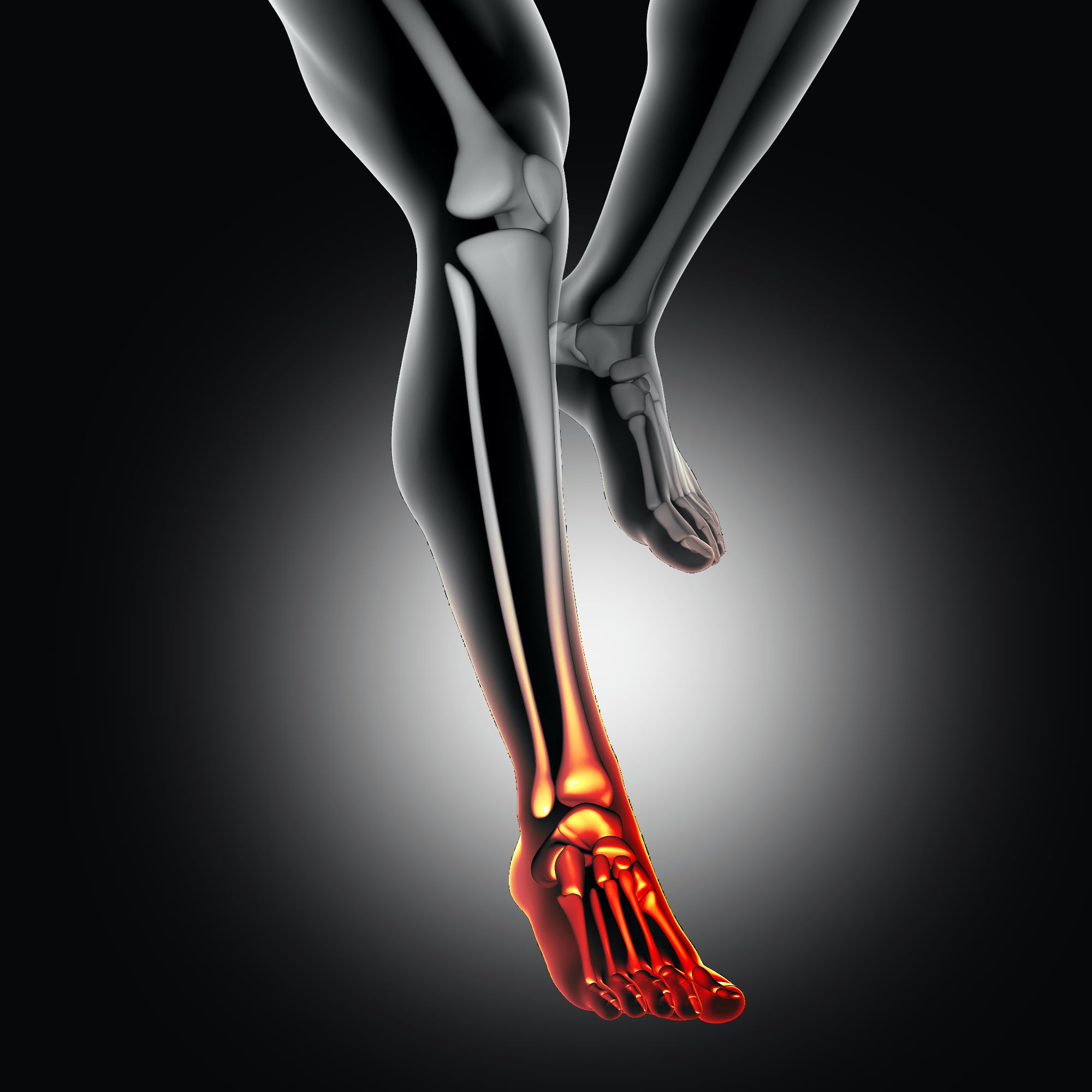 Laser‐Schmerz­therapie für Schmer­zen im Fuß­gelenk