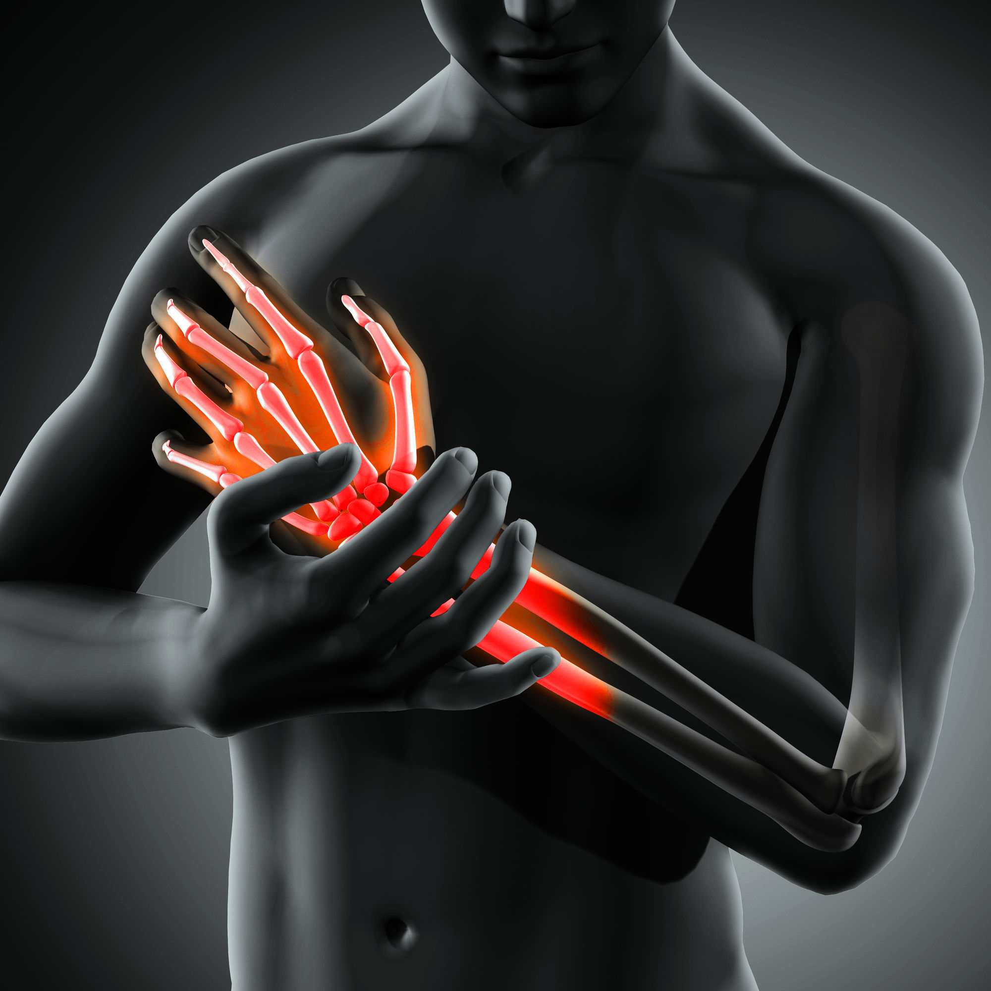 Laser‐Schmerz­therapie für Schmer­zen im Hand­gelenk